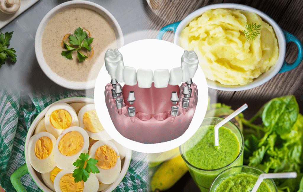 Chăm sóc Implant đúng cách không chỉ ngăn ngừa biến chứng mà còn giúp kéo dài tuổi thọ trụ lâu hơn